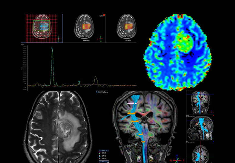 Johns Hopkins Cardiac CT Practicum: The Total Experience November