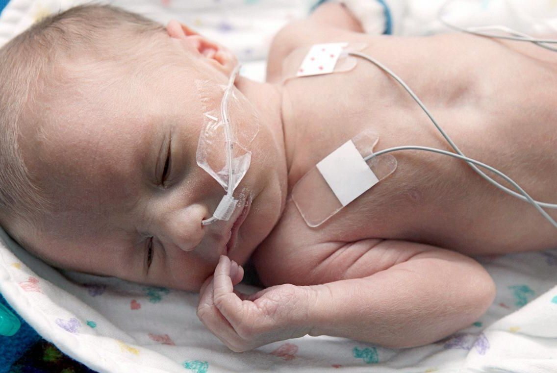 Assessment and Care of the Late Preterm Infant